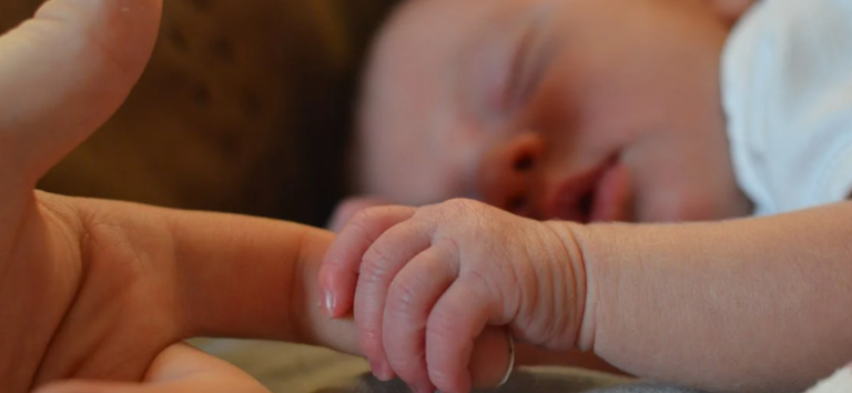 Penyebab Kulit Bayi Merah dan Mengelupas Panduan Lengkap untuk Orang Tua